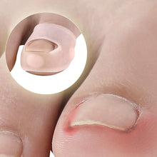 HEALLILY Ingrown Toenail Tool Toenail Corrector Patch Paronychia Toenail Treatment Tape Toenail Correction Sticker Paronychia Recover Foot Care Tool 3 Pairs