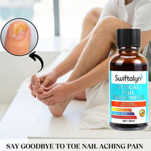 Fungal Nail Treatment:Fungal Nail Treatment for Toenails Extra Strong-Nail Fungus Treatment for Toenail-Nail Fungal Treatment-30ML