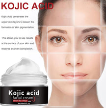 Kojic Acid Face Cream with Retinol - Skincare Retinol Face Cream - Kojic Acid Skin Lightening Cream for Dark Skin - Moisturiser Hydrate Plump Firm Pore - Reduce Dullness Restore Radiant Anti Oxidation