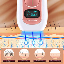 IPL Hair Removal Device, Laser Hair Removal for Women and Men, 999,000 Flashes, 5 Energy Levels, 2 Modes, Painless Hair Remover for Facial Legs Arms Whole Body