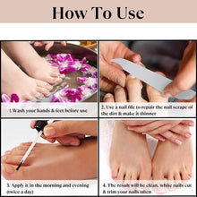 Fungal Nail Treatment:Fungal Nail Treatment for Toenails Extra Strong-Nail Fungus Treatment for Toenail-Nail Fungal Treatment-30ML