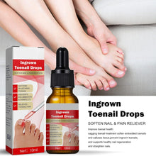 Ingrown Toenail Treatment Drop- Ingrown Toenail Treatment- Cuticle Care Oils for Ingrown Toenails - Trimming Toenail Softening Drops Natural Ingrown Toenail Correction Fungal Nail - 10ml (1Pcs)