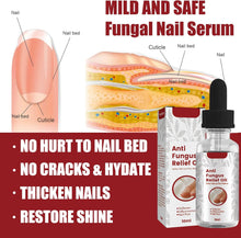 Fungal Nail Serum For Toenails Extra Strong, Ingrown Toenail Serum Nail Care Serum, Nail Fungus Serum For Toenail Improve, Nail Strengthener, For Damaged & Thick Nails