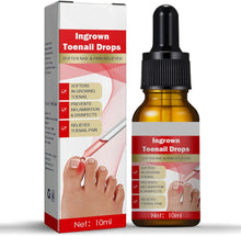 Ingrown Toenail Treatment Drop- Ingrown Toenail Treatment- Cuticle Care Oils for Ingrown Toenails - Trimming Toenail Softening Drops Natural Ingrown Toenail Correction Fungal Nail - 10ml (1Pcs)