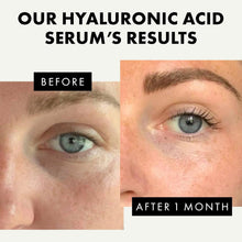 Hyaluronic Acid Face Serum - 2.5% Pure Hyaluronic Serum + 3% B5, Anti Wrinkle + Anti Aging Hyaluronic Acid Serum for Face with Vitamin C & E, Aloe - Antiaging Hydrating Serums Skincare