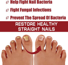 Fungal Nail Serum For Toenails Extra Strong, Ingrown Toenail Serum Nail Care Serum, Nail Fungus Serum For Toenail Improve, Nail Strengthener, For Damaged & Thick Nails