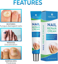 Fungal Nail Treatment, Fungus Nail Cream, Strong Anti-Fungal Toenail Cream, Nail Repair Nourishing Treatment, Restores Discolored and Damaged Nails