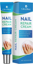 Fungal Nail Treatment, Fungus Nail Cream, Strong Anti-Fungal Toenail Cream, Nail Repair Nourishing Treatment, Restores Discolored and Damaged Nails