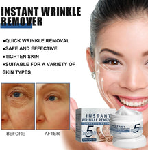 5 Seconds Wrinkle Remover,Instant Anti-Aging Face Cream,5 Seconds Retinol Anti-Wrinkle Cream,Rapid Wrinkle Repair Cream,Wrinkle Remover Instant Firmly Face Cream,5 Seconds Anti Wrinkle Face Cream 30G