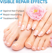 Fungal Nail Treatment, Fungus Nail Cream, Strong Anti-Fungal Toenail Cream, Nail Repair Nourishing Treatment, Restores Discolored and Damaged Nails