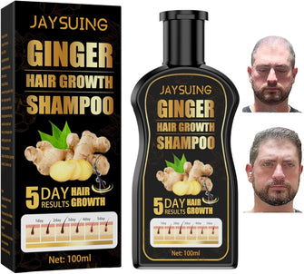 Ginger Hair Growth Shampoo,Ginger Shampoo,Natural Anti Hair Loss Shampoo,Hair Growth Shampoo and Conditioner,Hair Regrowth Treatment for Men,Anti Dandruff Shampoo Men,Mens Shampoo for Hair Growth