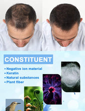 Hair Building Fibres, Conceals hair loss and covers up roots - Densifies and thickens thinning hair - Microfibres of natural keratine for Men & Women Hair Loss Treatment in Seconds 27.5g (Dark Brown)