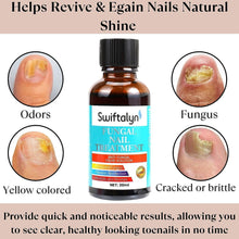 Fungal Nail Treatment:Fungal Nail Treatment for Toenails Extra Strong-Nail Fungus Treatment for Toenail-Nail Fungal Treatment-30ML