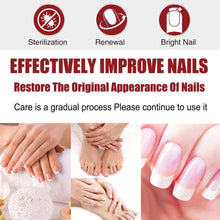 Fungal Nail Serum For Toenails Extra Strong, Ingrown Toenail Serum Nail Care Serum, Nail Fungus Serum For Toenail Improve, Nail Strengthener, For Damaged & Thick Nails