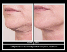 Neck Firming Cream with Peptides & Retinol - Anti Aging Skin Tightening Cream to Reduce Wrinkles, Neck Lines, Age Spots & Sagging Skin - Natural Firming Neck Cream for Smooth & Youthful Skin - 1.7 oz