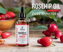 Kanzy Rosehip Oil for Face 120ml Organic Cold Pressed 100% Pure Natural, Hydrating, Nourishing & Moisturising Rosehip Seed Oil for Skin, Hair, Nails, and Body Oil