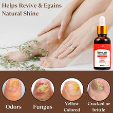 Fungal Nail Treatment: Nail Fungus Treatment for Toenail - Fungal Nail Treatment for Toenails Extra Strong - Toe Nail Fungal Treatment - Safely and Gently Reclaim Healthy Nails - 30ml