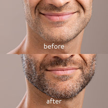 Navaris Beard Roller - Facial Hair Growth Grooming Tool for Men Face Hairs Derma Regrowth - Dermaroller for Mens Facial Hairs with Storage Box