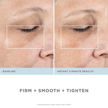 NuFACE FIX Line Smoothing Device