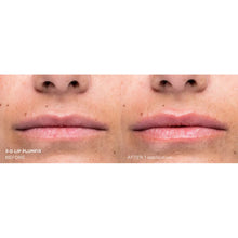 Dr. Brandt Needles No More 3D Lip Plumpfix 10g