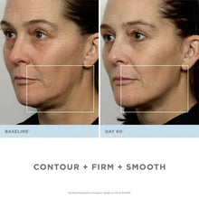 NuFACE Trinity Complete Facial Toning Kit - Anniversary Collection (Worth £599.00)