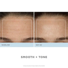 NuFACE Trinity Complete Facial Toning Kit - Anniversary Collection (Worth £599.00)