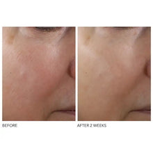 Dr. Dennis Gross Skincare Advanced Retinol and Ferulic Texture Renewal Serum