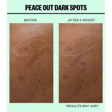 Peace Out Peace Out Dark Spots