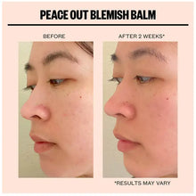 Peace Out Blemish Balm