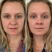 Alpha-H Vitamin A Serum with 0.5% Retinol 25ml