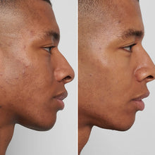 The INKEY List Mandelic Acid Treatment 15ml