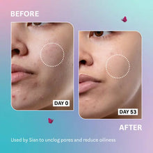 Selfless by Hyram Salicylic Acid and Sea Kelp Pore Clearing and Oil Control Serum 40ml