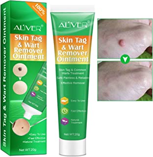 Skin Tag Remover Warts & Mole Remover Cream