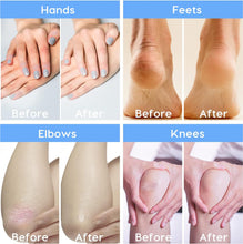 Urea Cream,GIMGO Foot Cream for Cracked Heels and Dry Skin,Urea Foot Cream 40%,Cracked Heel Repair Cream For Feet,Knees,Hand&Elbows,Rough,Cracked,Dead Skin,4.3oz(120g)