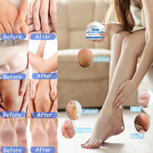 Urea Foot Cream,Urea Cream for Feet,Urea Foot Cream 42 Percent Foot Cream for Cracked Heels and Dry Skin Deep Moisturizing,Callus Remover Nourishes Soften For Feet,Knees,Hand Cracked Skin-100g