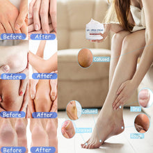 Urea Foot Cream,Urea Cream for Feet,Urea Foot Cream 40 Percent Foot Cream for Cracked Heels and Dry Skin Deep Moisturizing,Callus Remover Nourishes Soften For Feet,Knees,Hand