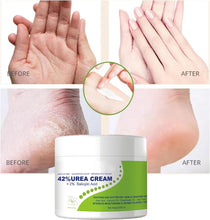 Urea 42% Foot Cream,Foot Cream For Cracked Heels And Dry Skin,Foot Moisturiser,Foot Care cream,Deep Hydrating & Smooth Dull Skin,Hard Skin Remover Foot Cream,Athlete Foot Cream-Hand & Foot Care-100g