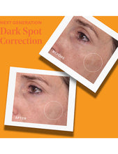 Rapid Dark Spot Correcting serum 30ml